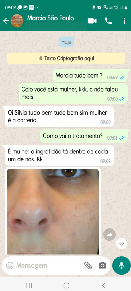 depoimento 2 Cicatridiva pelo Whatsapp