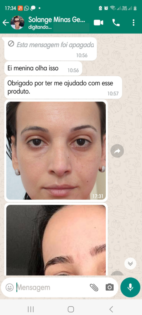 depoimento de Cicatridiva de uso do produto